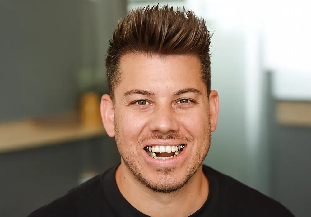 Snoring Splints: Custom Fit vs. OTC Effectiveness Explained